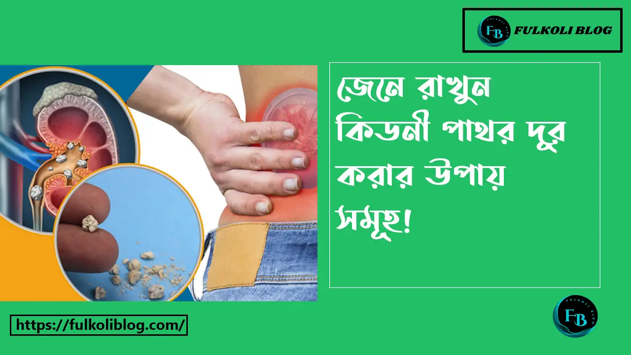 কিডনির পাথর দূর করার উপায়